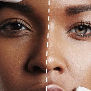 Skin Radiance